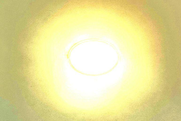 Occhi sensibili alla luce? Scopri tutto sulla fotofobia e come alleviarla